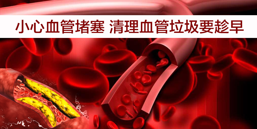 當(dāng)心！這幾類人群血管最易堵，適當(dāng)補(bǔ)硒遠(yuǎn)離血管疾病